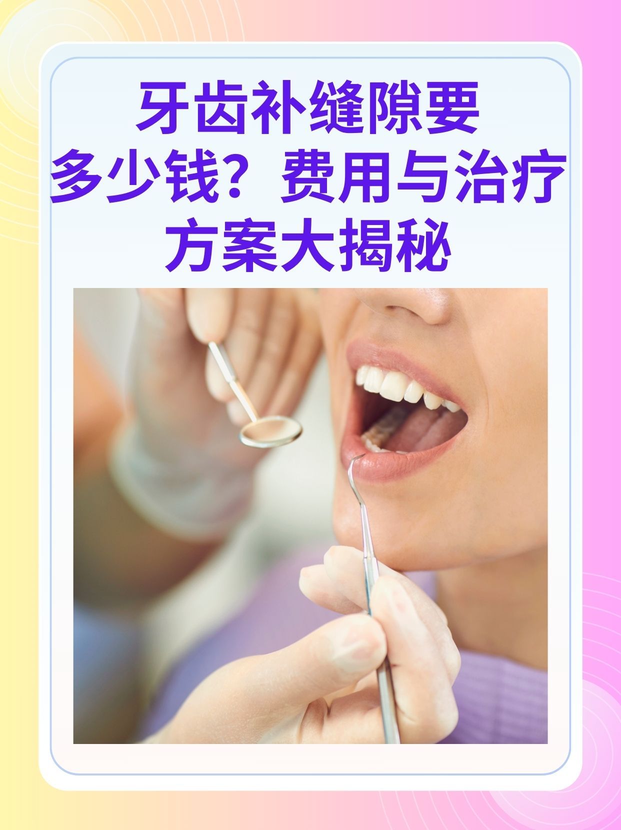 池州补牙医保可以报销吗(补牙医保可以报销吗 哪些可以报销呢)